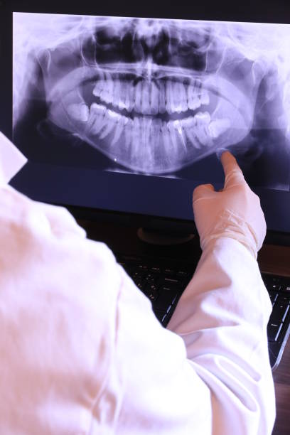 Best Emergency Dentist for Lost Fillings or Crowns in Clute, TX