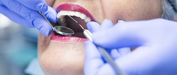 Best Emergency Dental Services for Seniors in Clute, TX